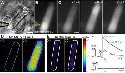 Regulation of cochlear hair cell function by intracellular calcium stores